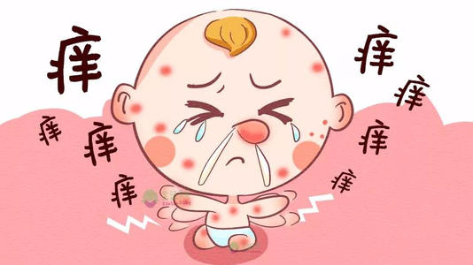 過敏有什么癥狀表現(判斷是否過敏的方法) 過敏有什么癥狀表現(判斷是否過敏的方法)