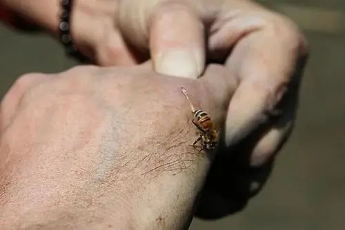 被蜜蜂蜇傷怎么辦(蜜蜂蟄傷了怎么處理) 被蜜蜂蜇傷怎么辦(蜜蜂蟄傷了怎么處理)