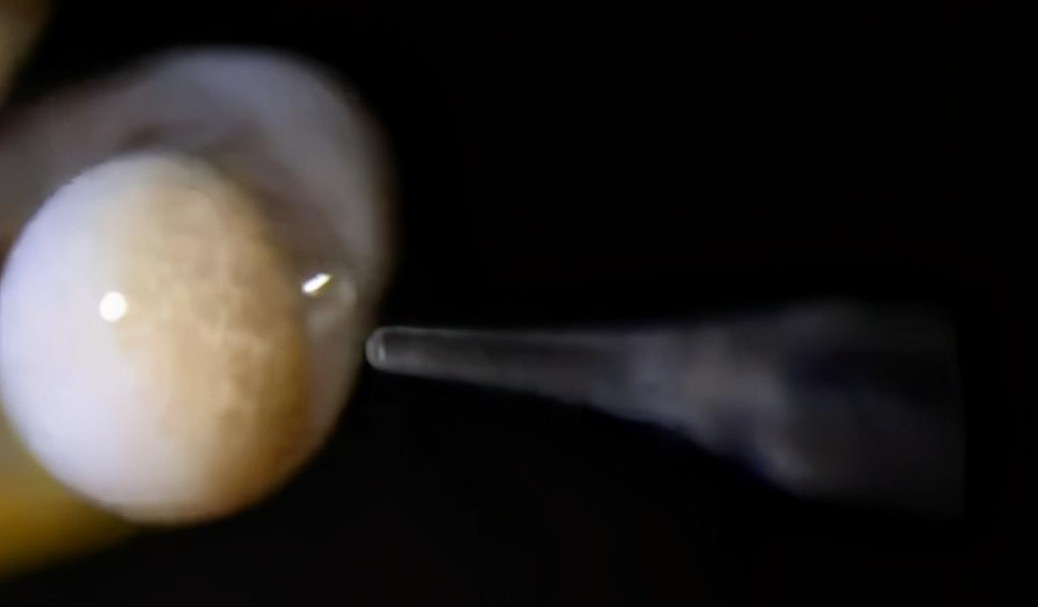 產雄蜂的王如何人工授精(蜂王人工授精技術視頻) 產雄蜂的王如何人工授精(蜂王人工授精技術視頻)