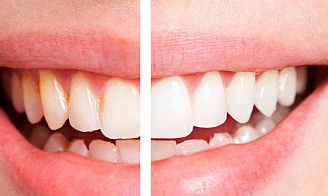 牙齒開始“衰老”的三大癥狀，你可要當(dāng)心了